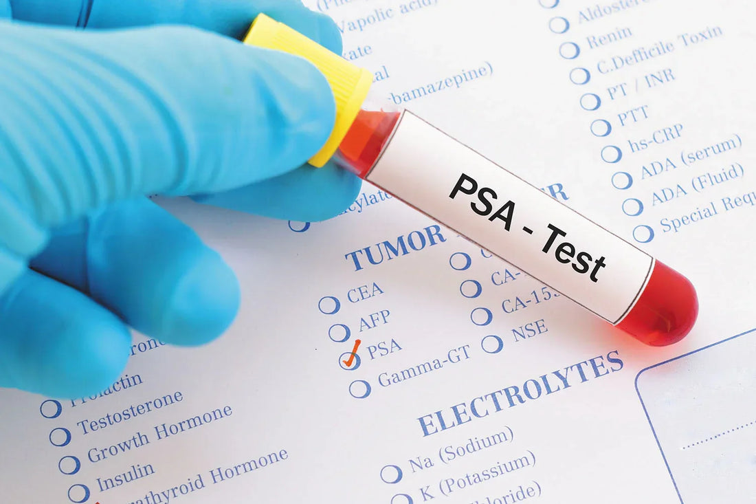 How Often Should You Take a PSA Test? | STI Health Check
