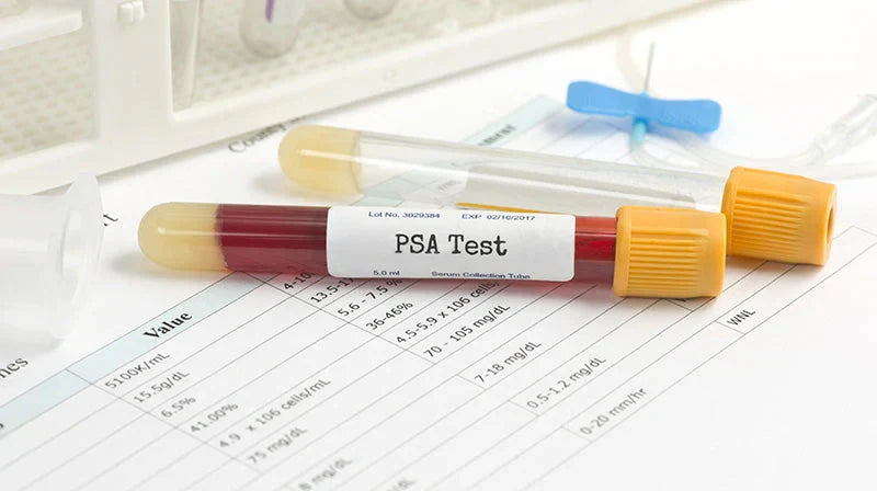 How to Use a PSA Rapid Test at Home: Step-by-Step Guide | STI Health Check