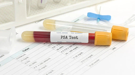 How to Use a PSA Rapid Test at Home: Step-by-Step Guide | STI Health Check