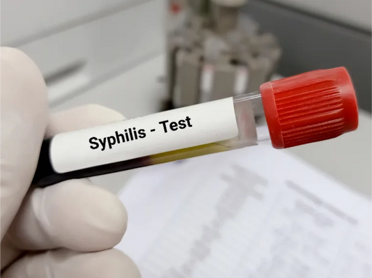 Syphilis Symptoms in Men and Women | Early Warning Signs Explained